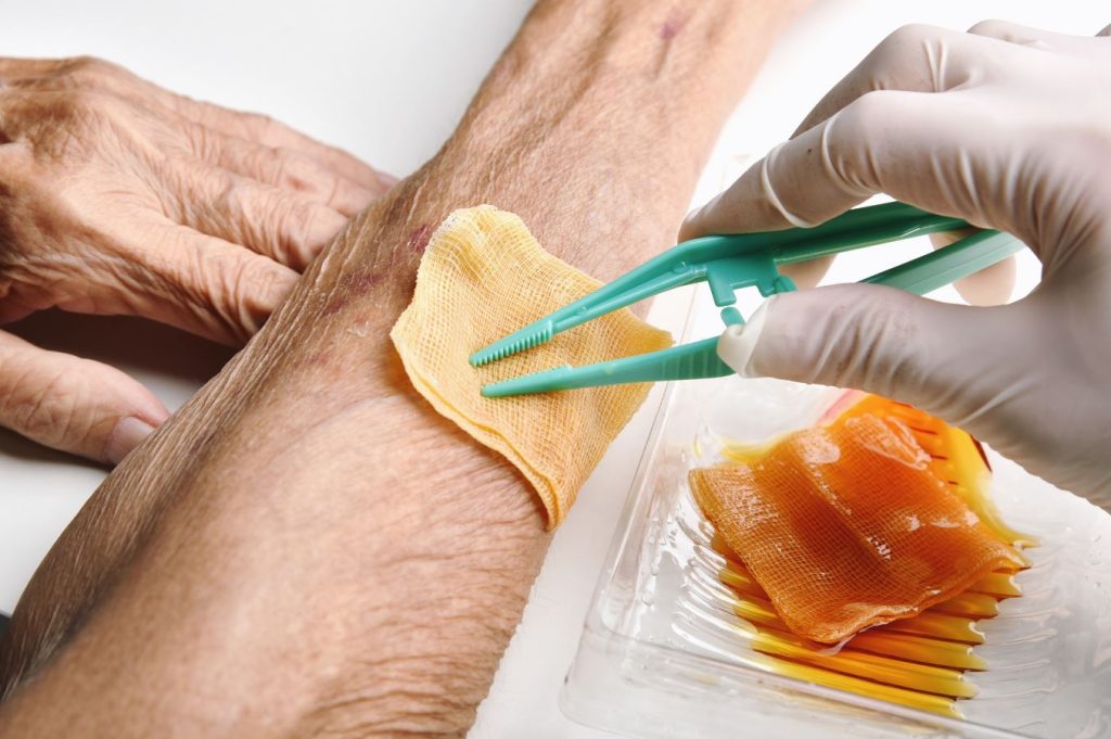 Wound care & healing at MM Care