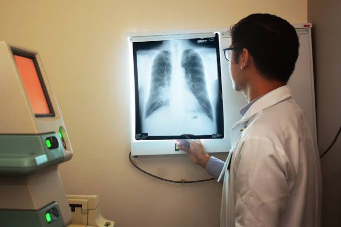 On-site X-ray at MM Care